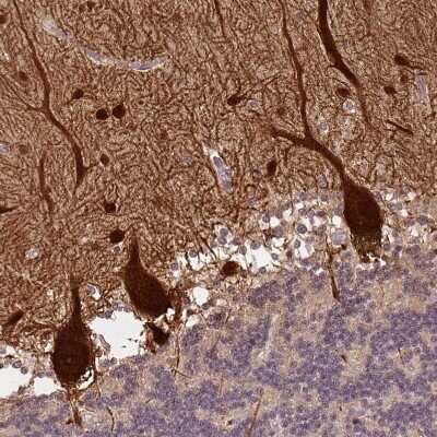 Immunohistochemistry-Paraffin: Parvalbumin Antibody [NBP2-33529]