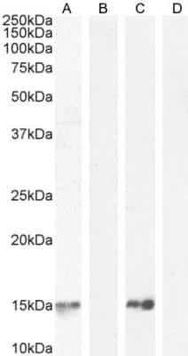 Western Blot: Parvalbumin Antibody [NB100-1541]