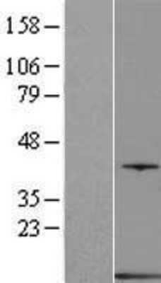 Western Blot: Parvalbumin Overexpression Lysate [NBP2-10851]