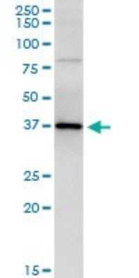 Immunoprecipitation: Parvin gamma Antibody (4E1) [H00064098-M01]