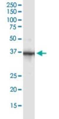 Immunoprecipitation: Parvin gamma Antibody [H00064098-B01P]