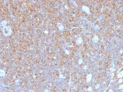 Immunohistochemistry-Paraffin: Parvin gamma Antibody (PARVG/6312R) - Azide and BSA Free [NBP3-08729]