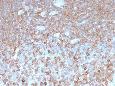 Immunohistochemistry-Paraffin: Parvin gamma Antibody (PARVG/6312R) [NBP3-07836]