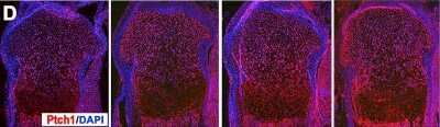 Immunohistochemistry: Patched 1/PTCH Antibody - BSA Free [NB200-118]
