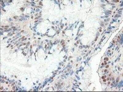 Immunohistochemistry-Paraffin: Patched 1/PTCH Antibody (OTI5C7) [NBP1-47945]