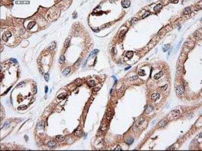 Immunohistochemistry-Paraffin: Patched 1/PTCH Antibody (OTI5C7) [NBP1-47945]
