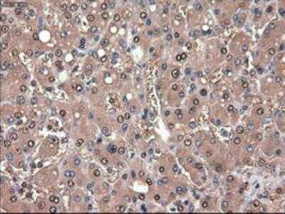 Immunohistochemistry-Paraffin: Patched 1/PTCH Antibody (OTI5C7) [NBP1-47945]