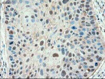 Immunohistochemistry-Paraffin: Patched 1/PTCH Antibody (OTI5C7) [NBP1-47945]