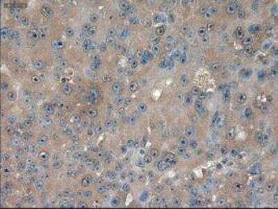 Immunohistochemistry-Paraffin: Patched 1/PTCH Antibody (OTI5C7) [NBP1-47945]