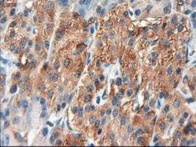 Immunohistochemistry-Paraffin: Patched 1/PTCH Antibody (OTI5C7) [NBP1-47945]