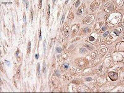 Immunohistochemistry-Paraffin: Patched 1/PTCH Antibody (OTI5C7) [NBP1-47945]