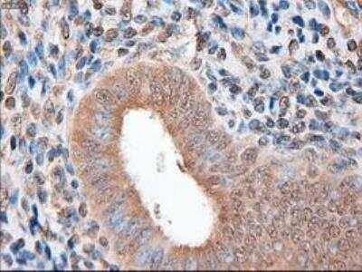 Immunohistochemistry-Paraffin: Patched 1/PTCH Antibody (OTI5C7) [NBP1-47945]