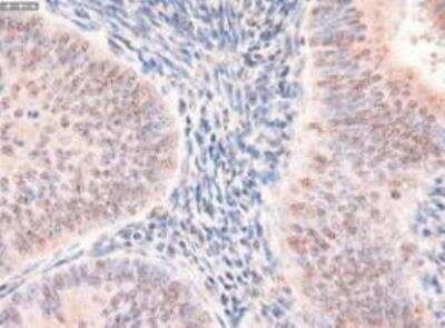 Immunohistochemistry-Paraffin: Patched 1/PTCH Antibody (OTI5C7) [NBP1-47945]
