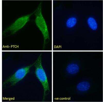 Immunocytochemistry/ Immunofluorescence: Patched 1/PTCH Antibody [NB100-41101]