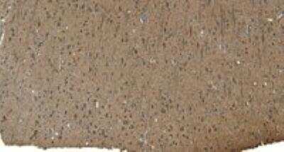 Immunohistochemistry-Paraffin: Patched 1/PTCH Antibody [NB100-2451]