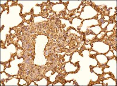 Immunohistochemistry-Paraffin: Patched 1/PTCH Antibody - BSA Free [NBP1-71662]