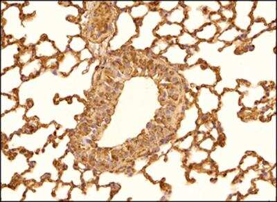 Immunohistochemistry-Paraffin: Patched 1/PTCH Antibody - BSA Free [NBP1-71662]