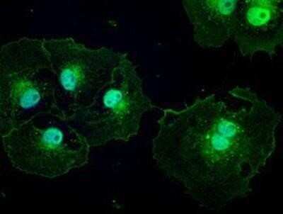 Immunocytochemistry/ Immunofluorescence: Patched 1/PTCH Antibody (OTI5C7) - Azide and BSA Free [NBP2-73253]