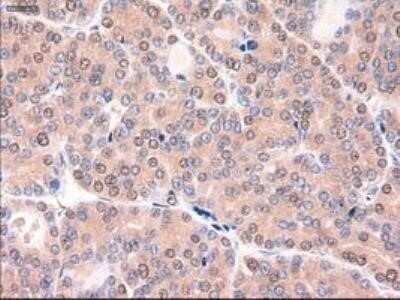 Immunohistochemistry: Patched 1/PTCH Antibody (OTI5C7) - Azide and BSA Free [NBP2-73253]