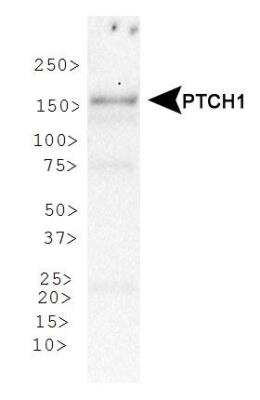 Western Blot: Patched 1/PTCH AntibodyBSA Free [NBP1-71662]
