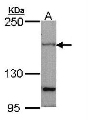 Western Blot: Patched 1/PTCH Antibody [NBP2-19705]