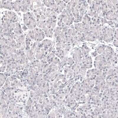 Immunohistochemistry-Paraffin: Pax2 Antibody (CL9469) [NBP2-88934]