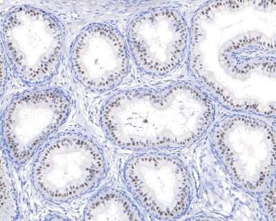 Immunohistochemistry-Paraffin: Pax2 Antibody (JJ082-08) [NBP2-67849]