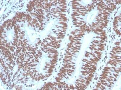 Immunohistochemistry-Paraffin: Pax2 Antibody (PAX2/1104) - Azide and BSA Free [NBP2-79877]