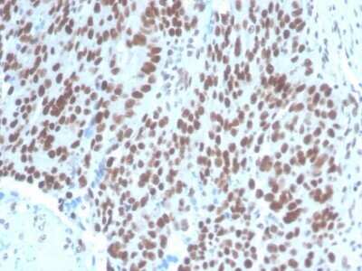 Immunohistochemistry-Paraffin: Pax2 Antibody (PAX2/1104) - Azide and BSA Free [NBP2-79877]
