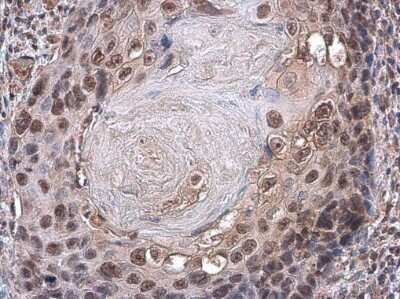 Immunohistochemistry-Paraffin: Pax3 Antibody (GT1210) [NBP3-13613]