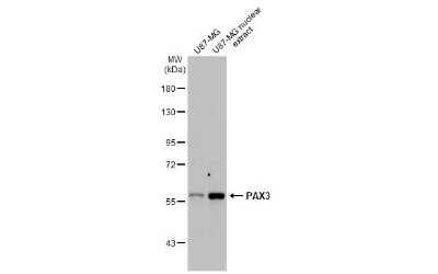 Western Blot: Pax3 Antibody (HL160) [NBP3-13661]