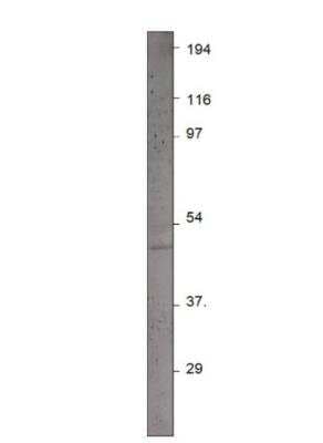 Western Blot: Pax4 Antibody [NBP3-12485]