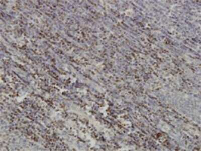 Immunohistochemistry-Paraffin: Pax5/BSAP Antibody (8F9) [H00005079-M01]