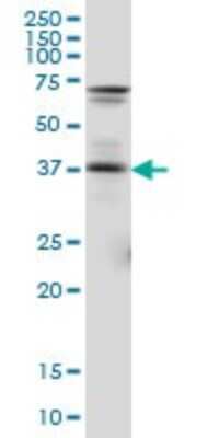 Western Blot: Pax5/BSAP Antibody (8F9) [H00005079-M01]