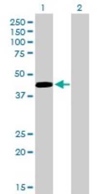 Western Blot: Pax5/BSAP Antibody (8F9) [H00005079-M01]