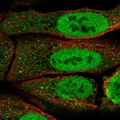 Immunocytochemistry/ Immunofluorescence: Pax5/BSAP Antibody [NBP2-57885]
