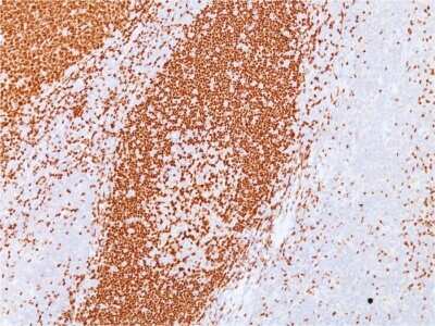 Immunohistochemistry-Paraffin: Pax5/BSAP Antibody (PAX5/3735) - Azide and BSA Free [NBP3-08418]