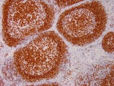 Immunohistochemistry-Paraffin: Pax5/BSAP Antibody (PAX5/3735) [NBP3-07581]