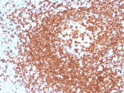 Immunohistochemistry-Paraffin: Pax5/BSAP Antibody (rPAX5/4228) [NBP3-07582]