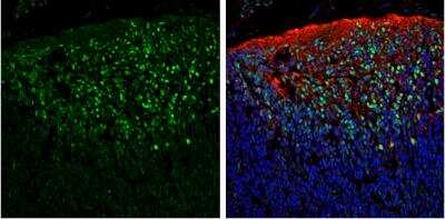 Immunohistochemistry-Frozen: Pax6 Antibody [NBP2-19711]