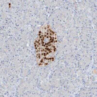 Immunohistochemistry-Paraffin: Pax6 Antibody [NBP1-89100]