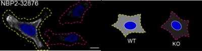 Knockout Validated: Pax6 Antibody (PAX6/1166) [NBP2-44576]