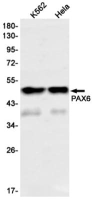 Western Blot: Pax6 Antibody (S01-1G8) [NBP3-19528]
