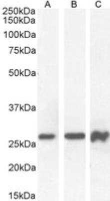 Western Blot: Pax6 Antibody [NB100-61654]