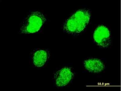Immunocytochemistry/ Immunofluorescence: Pax7 Antibody (1G11) [H00005081-M07]
