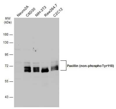 Western Blot: Paxillin Antibody (GT722) [NBP3-13562]