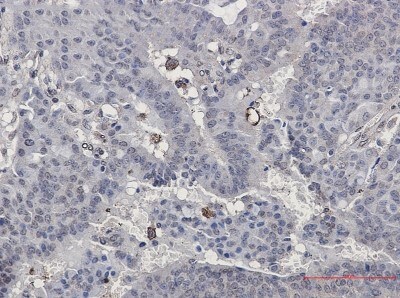 Immunohistochemistry-Paraffin: Paxillin Antibody (S04-3C3) [NBP3-20046]