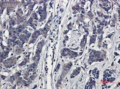 Immunohistochemistry-Paraffin: Paxillin Antibody (S07-1B4) [NBP3-20072]