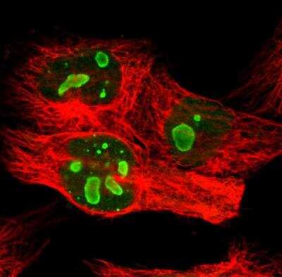 Immunocytochemistry/ Immunofluorescence: Pea3 Antibody [NBP1-87960]
