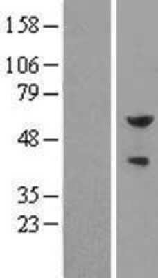 Western Blot: Pea3 Overexpression Lysate [NBL1-10360]